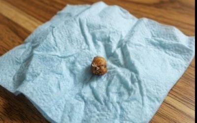 Nach einer erschreckenden Entdeckung unter der Dusche, die ein Paar davon überzeugte, dass etwas Schreckliches in ihren Haaren lebte, folgten