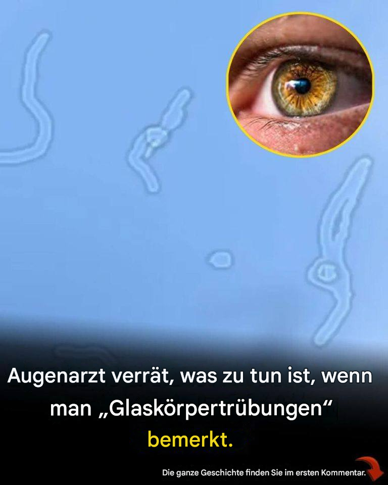 Was sind Glaskörpertrübungen? Was Sie tun sollten, wenn Sie sie bemerken – laut einem Augenarzt