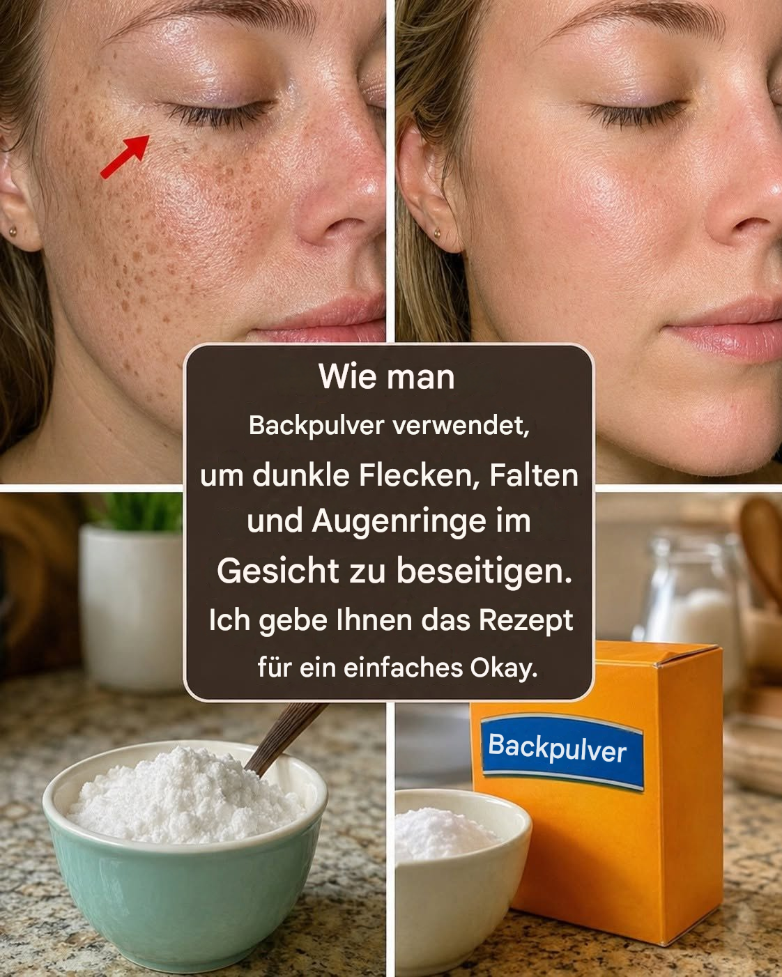 Wie man mit Backpulver dunkle Flecken, Falten und Augenringe im Gesicht entfernt.