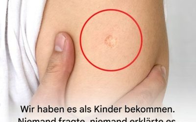 Die Wahrheit hinter der mysteriösen runden Narbe am Oberarm
