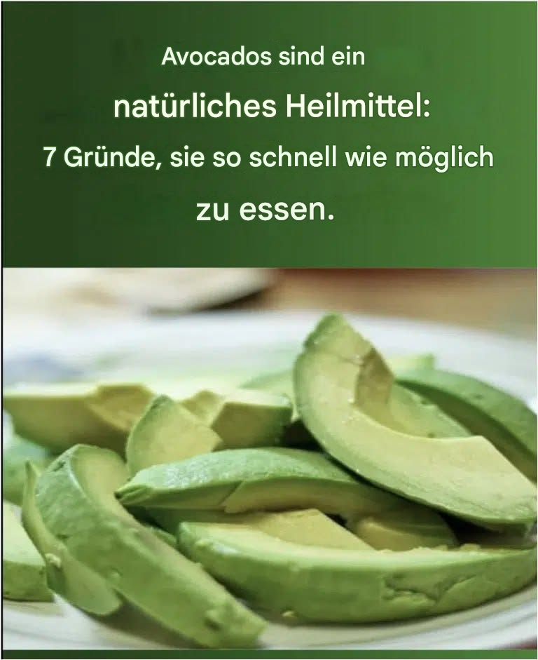 7 Gründe, warum Sie Avocados essen sollten