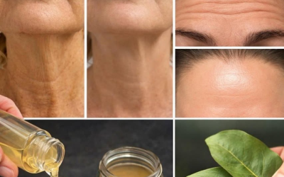 Warum Lorbeerblätter eine natürliche Lösung gegen Falten sind – 100.000 Mal wirksamer als Botox!