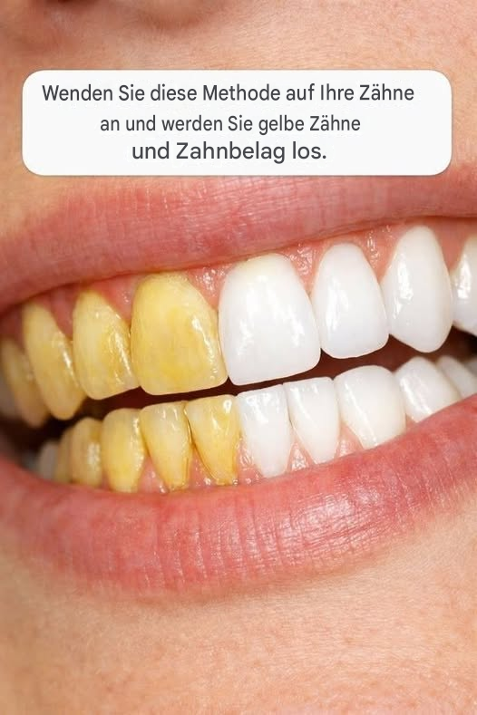 Eine einfache Zahnpflegemethode, die helfen kann, Plaquebildung zu reduzieren