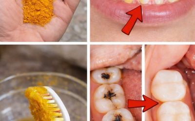 Kurkuma zur Zahnaufhellung: Funktioniert dieses natürliche Mittel wirklich?